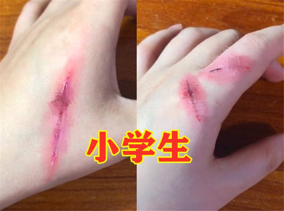 原创小学生开始流行画伤疤反映孩子心理状态父母能看出吗