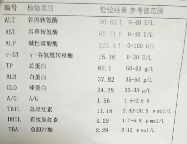 转氨酶检查图片