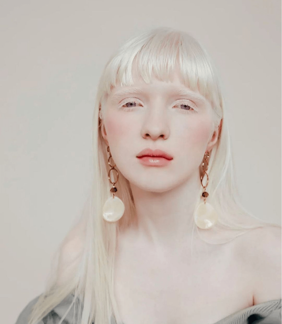 她被嘲"吸血鬼",21岁逆袭成超模,获网友大赞:天使路过人间!_nastya