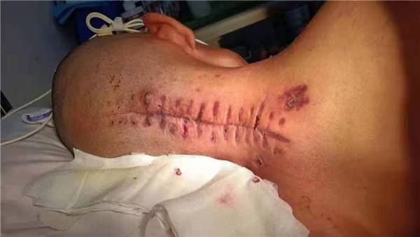 网红龙浩传递正能量帮助陈吉龙长征医院见证者的自述