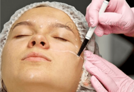 看拉皮手术全过程后想了解大拉皮手术能维持多久大概多少钱