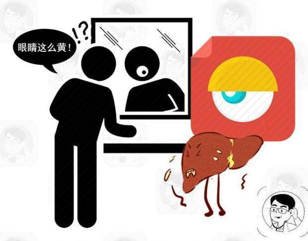 什么情况下要摘胆 4fc8b7da729343889d2395fdec6d4ff4.jpeg