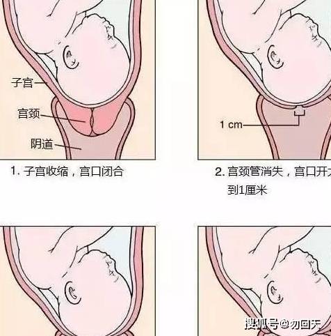 分娩前的宫缩是什么原理_宫缩是什么感觉(2)