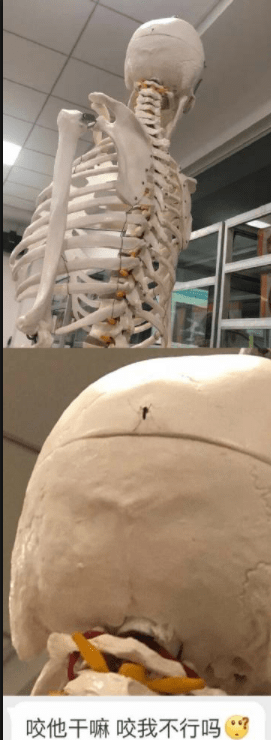 原创
让你们看看什么叫一口牙毁了整张脸!