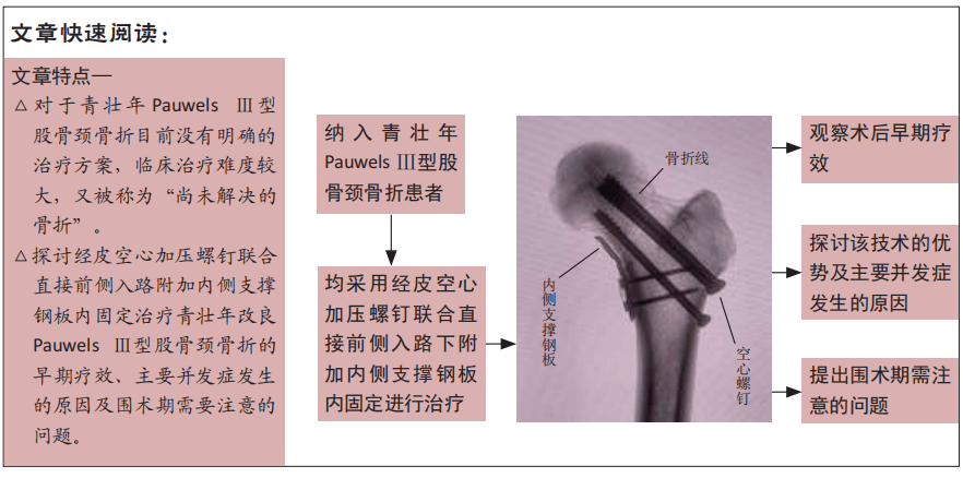 空心加壓螺釘聯合內側支撐鋼板置入治療青壯年改良pauwels Ⅲ型股骨頸