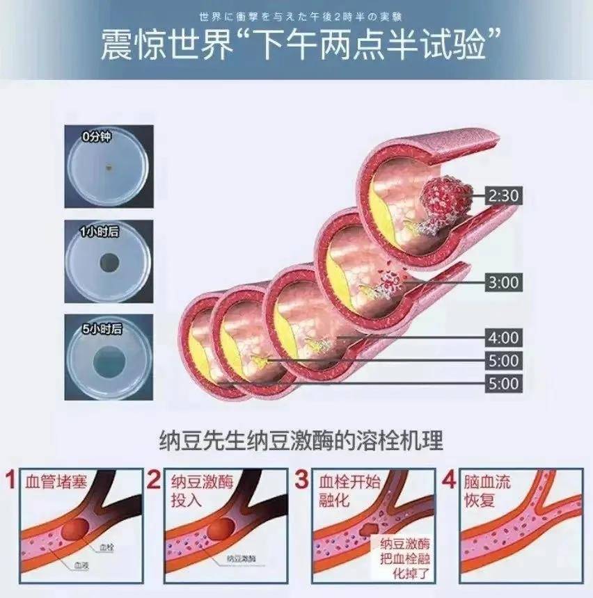 纳豆可以溶血栓和降三高你知道吗为父母收藏
