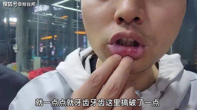 副驾美女嫌慢开到230码虎牙邓晶晶svj撞车千万跑车700万贱卖