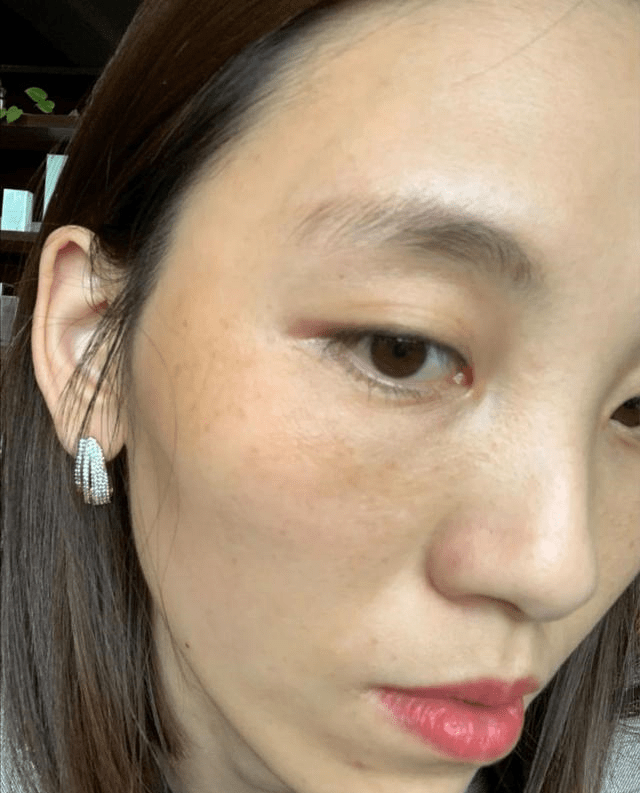 女生脸上出现这几个"信号",证明皮肤缺水,有3个以上皮肤很差