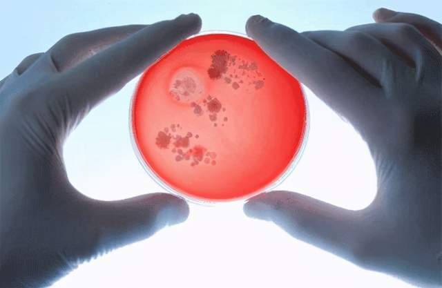 国内最新研究:揭示了粪菌移植对自闭症的影响