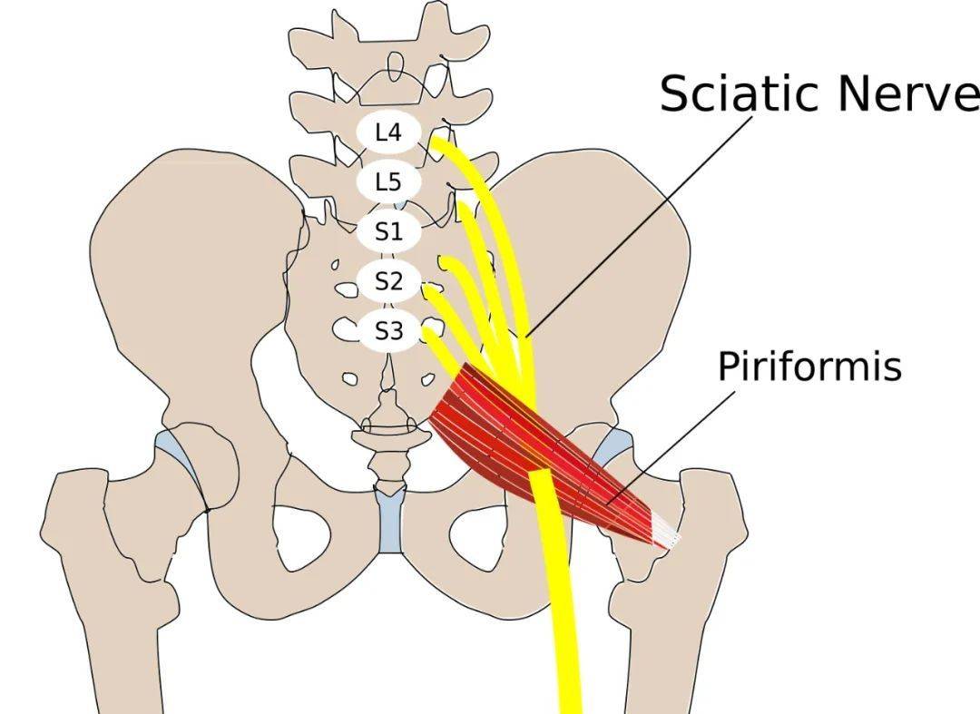 但也有约 22% 人群会出现坐骨神经穿过梨状肌的情况.