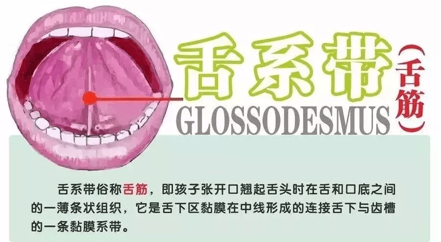 怎么看小孩舌系带短不短 e2ac04d31eed448d90f3f5bf0bf2f06d.png