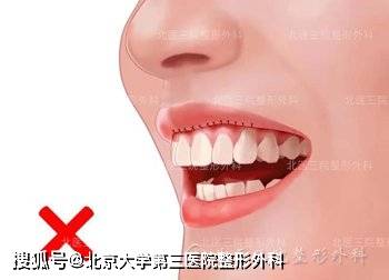 344d5fc19eaf4e76bdb93dfe921c952e.jpeg