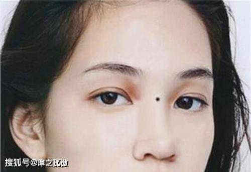 右颧骨有痣的女人图片