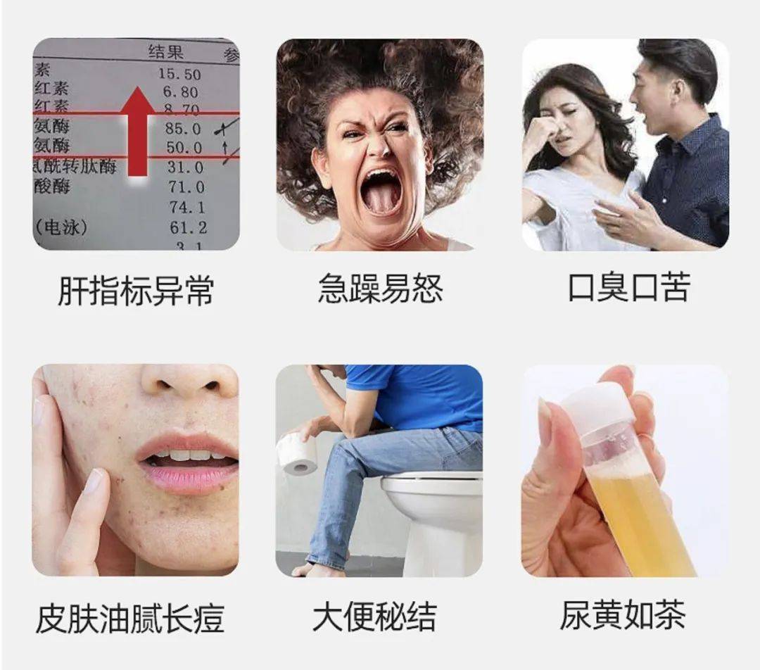 脂肪肝无症状?测测你发生脂肪肝的风险!_肝脏