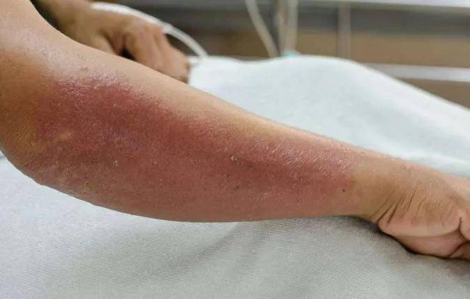 警惕白蚁入侵!你家厨柜快换掉!