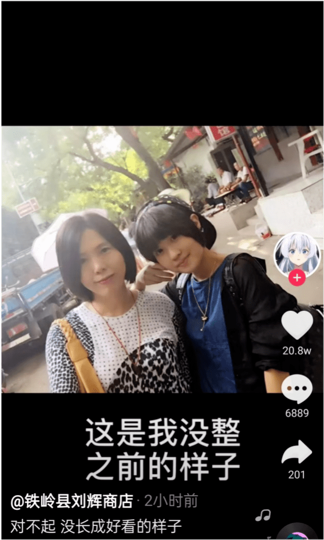 原创网红刘辉公开承认整容晒整容前后照片坦言还是觉得不好看最近又去