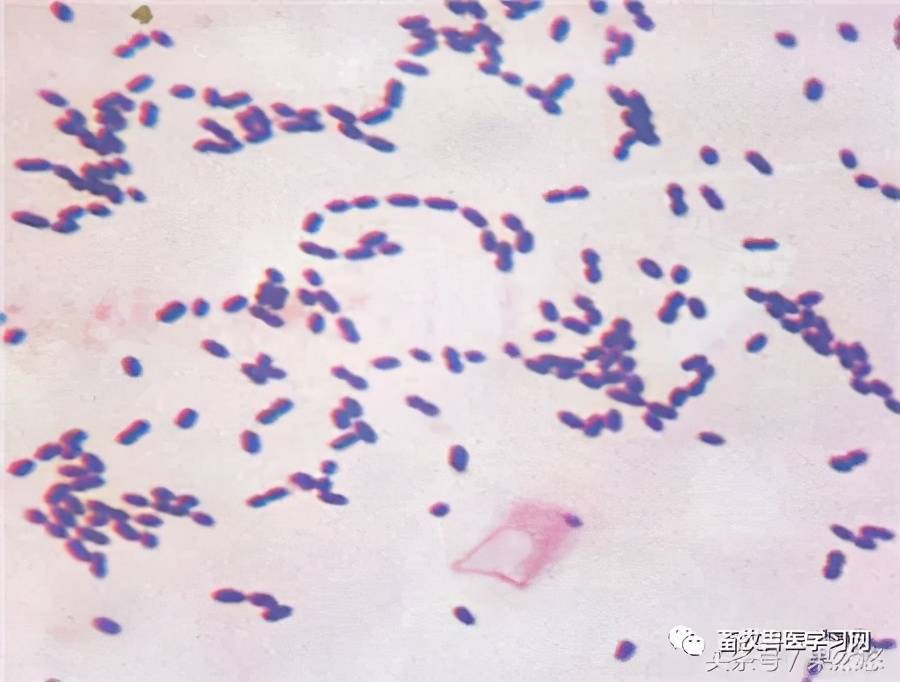 肺炎链球菌革兰染色图片
