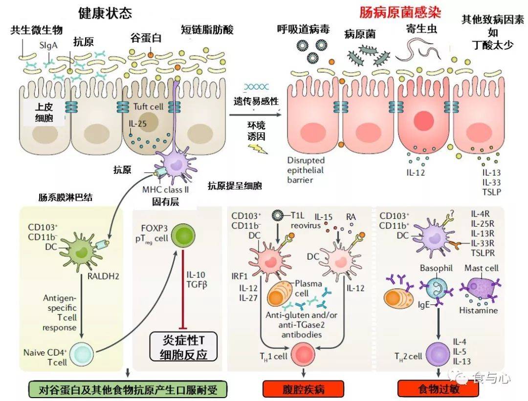 肠漏,你必须知道的热知识1:肠漏与消化道问题和癌症