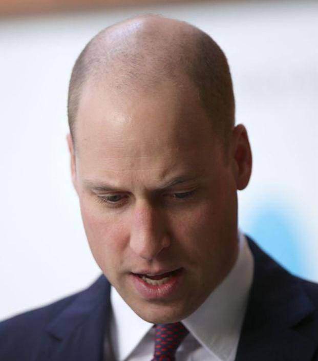 原创威廉王子也受脱发困扰 新发型超吸睛