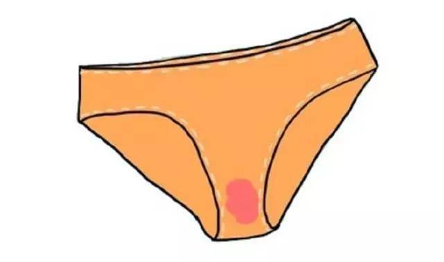 宫颈癌内裤颜色 症状图片