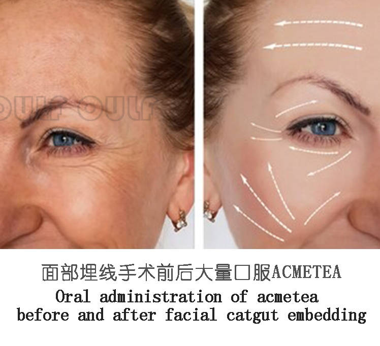 什么运动可以紧致下颚线 2f594fda58f248c4a7b2c8c0c6073297.jpeg