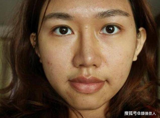 一、皮肤暗黄粗糙的原因