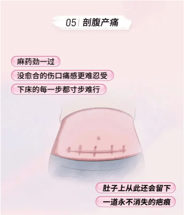 侧切缝针,生产的伤口还在流血,不打麻药,医生直接拿针缝合,穿针引线的