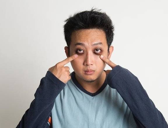 眼圈|怎么知道肝好不好？脸上出现3种异常，提示肝有问题