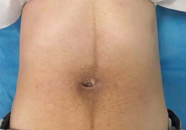 治疗|妈妈党必看|调整体态秒变美，不做“小乌龟”