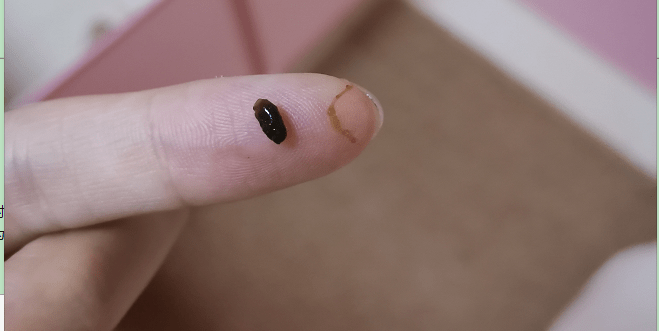 屎是黑的是怎么回事该怎么治 e6dcf98e8c584ed384479a5e06af3e15.png