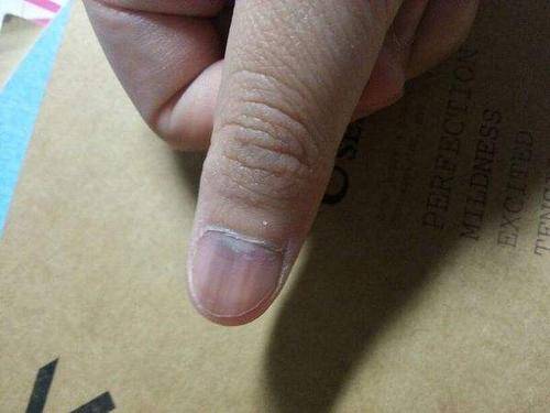 眼圈|肝不好的人,身体这4处会“发黑”,若一个不占,说明肝好得很!