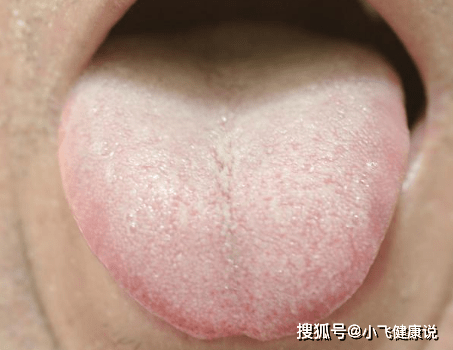 米乐app苹果下载安装