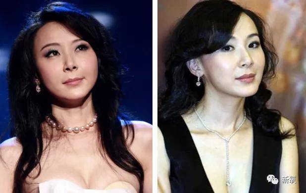因为|南韩唯一的纯天然美女，怎么40岁就变样了…