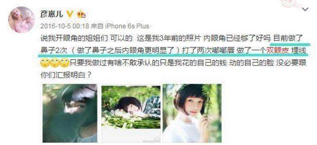 因为|整容有风险！她花了80万整容，还抽掉多根肋骨，最后却变成蟠桃精