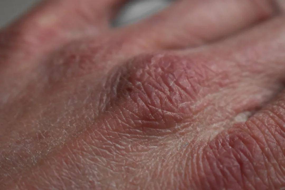 清洁|MoodRose科普 | 护肤精华贴，看这一篇就够了