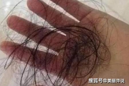 方法|女人头发少怎么增加发量？这三个方法让头发变浓密