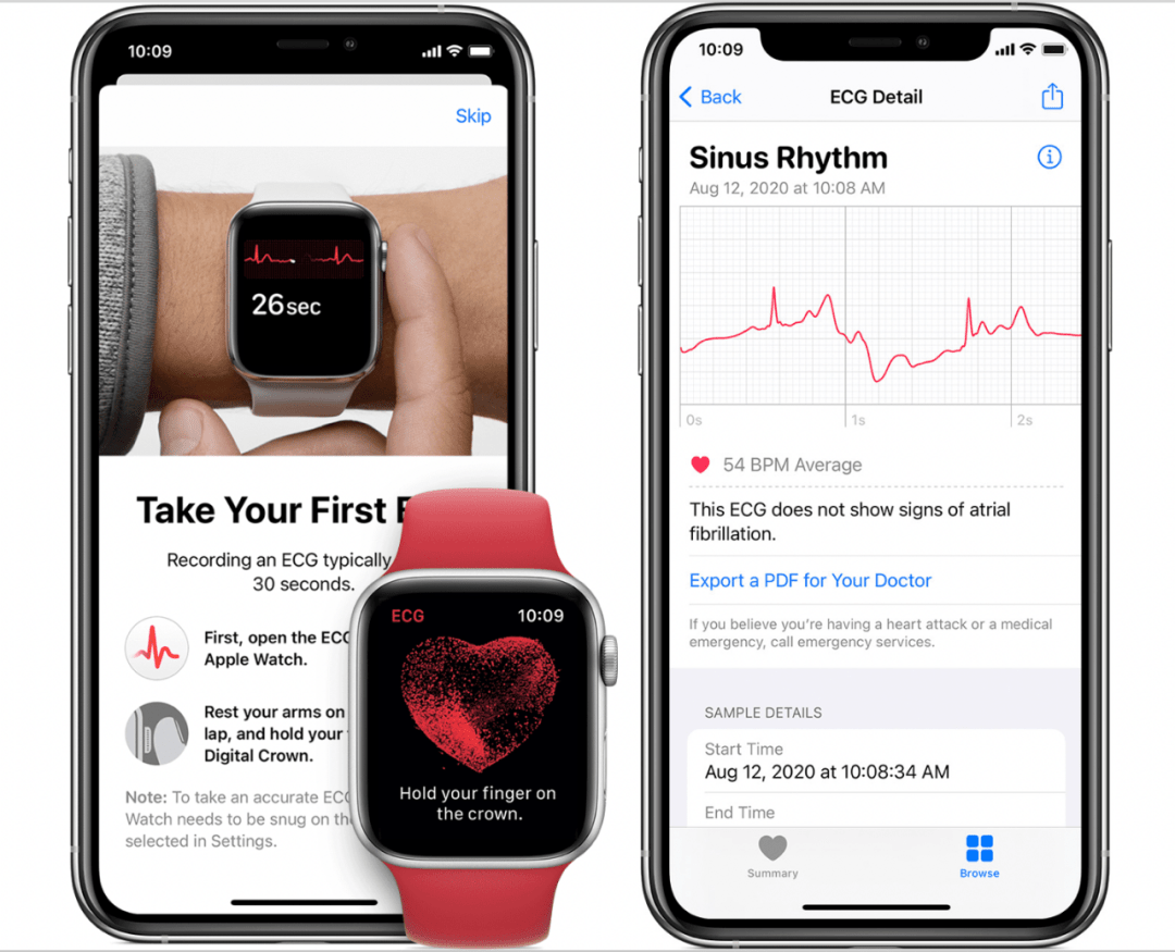 国行apple Watch的心电图获批了 但功能恐怕没那么强大 手表