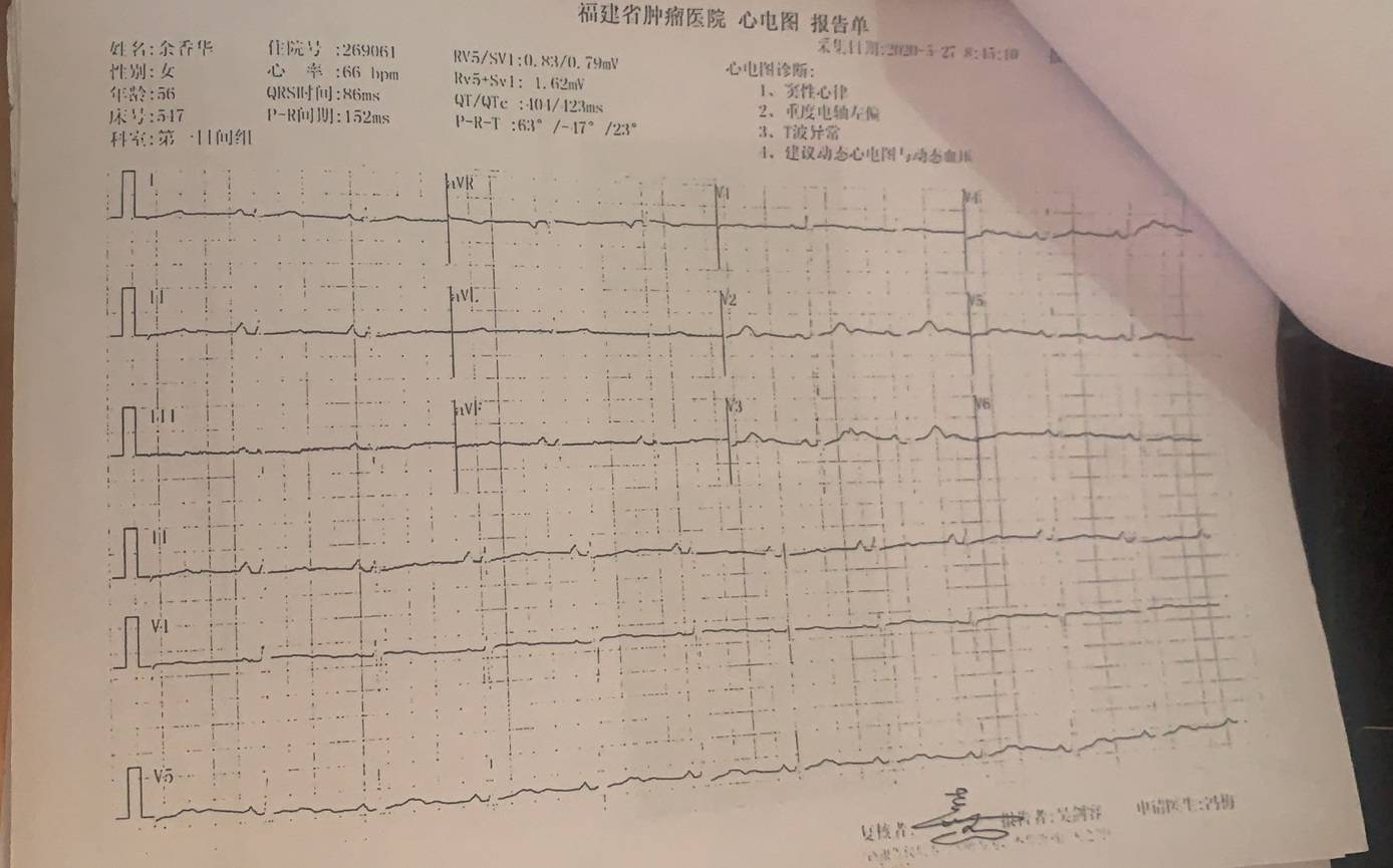 我现在是深刻的感受到了书中所说的"子欲养而亲不待",以前总觉得以后