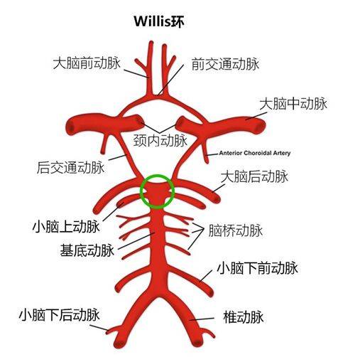 willis环基底动脉环图片