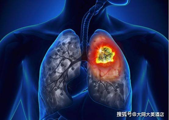 榴莲|经常吸烟的人,这3种水果尽量少吃!