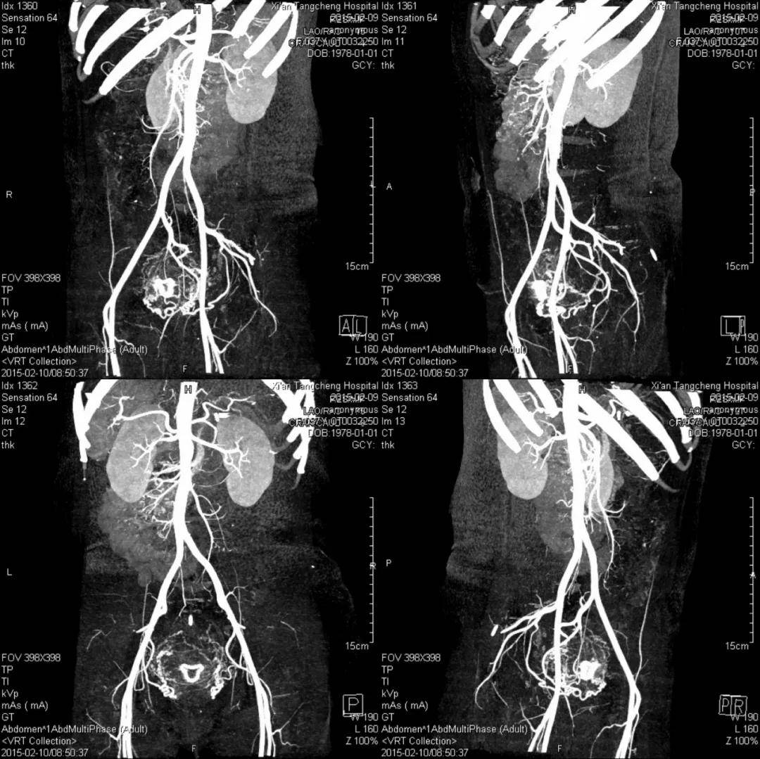 成像|【科室推荐】西安工会医院影像科