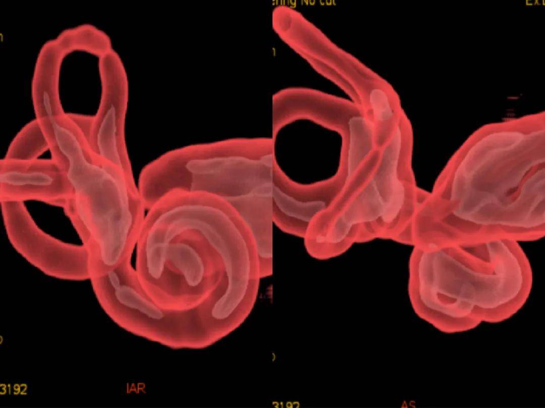 成像|【科室推荐】西安工会医院影像科