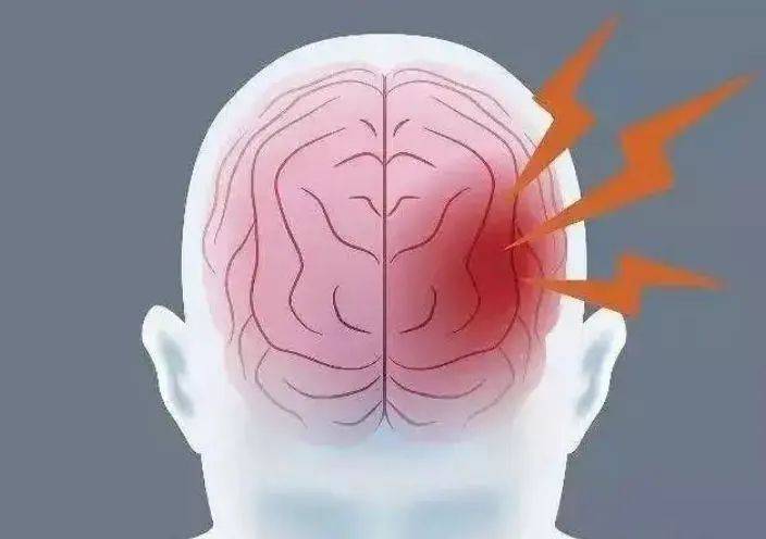 進行|請問腦梗有什么辦法可以治療？學習一些方法改善腦梗塞的癥狀