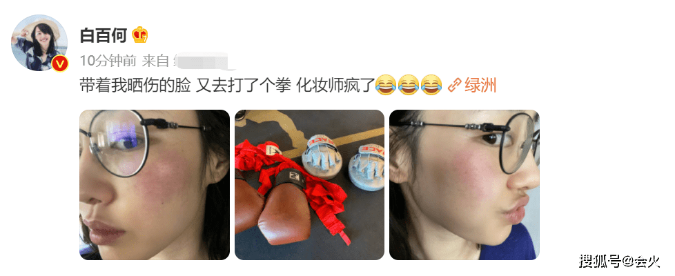 皮肤|白百何发晒伤自拍照！脸上发红一大片，镜头拉近后皮肤瑕疵明显