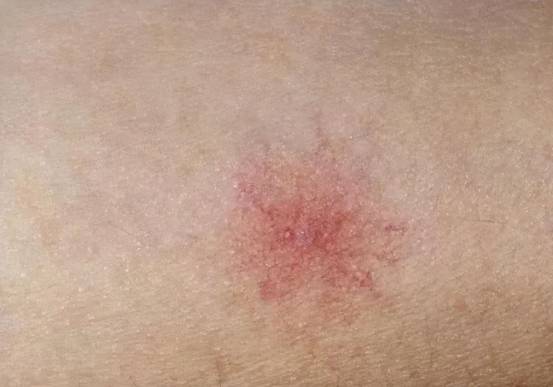 毒素|吃1口等于3斤绿豆，呼吁：肝不好的人不妨常吃，肝脏会感激你的