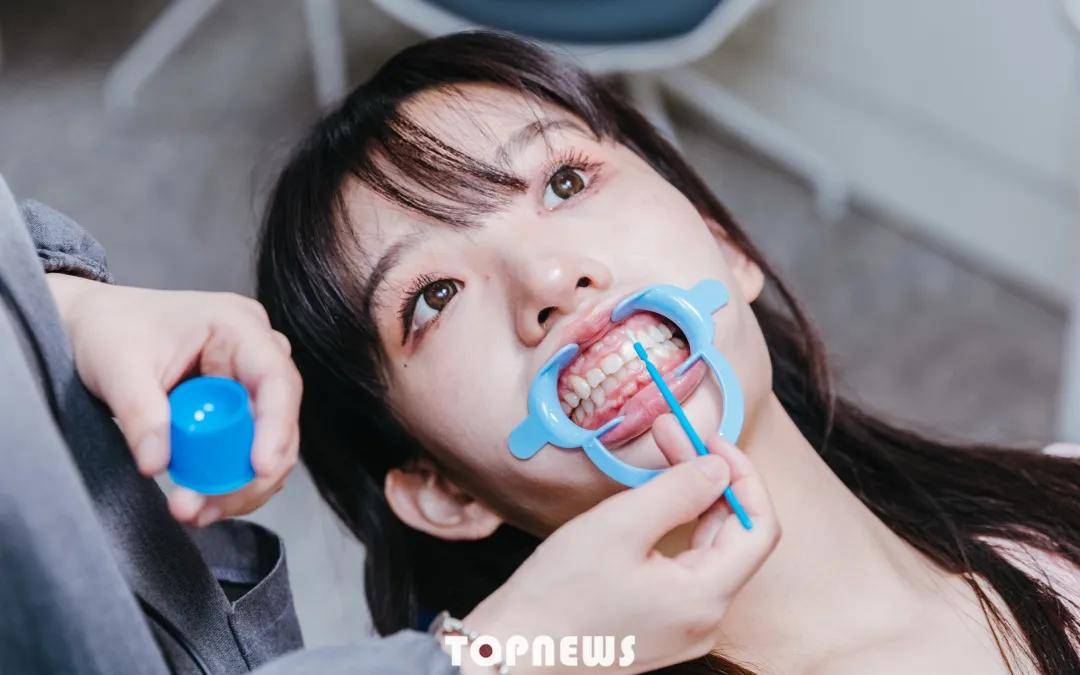 iTero|限时399元！抢千元“进口牙齿美白套餐”，拯救大黄牙！