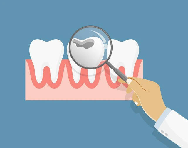 片子|在湖南邵东看牙齿，如何做到不花钱也能拍牙片？