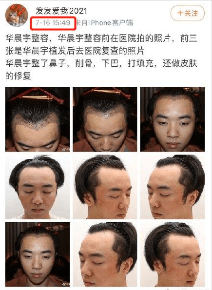 花边新闻|一瓜未平一瓜又起，被爆整容、CG的华晨宇，这次人设真的崩了吗