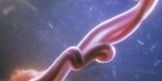 梦境的交织，解析梦见自己怀孕看见别人流产见血的深层含义