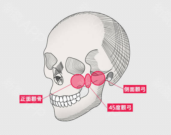 颧骨|圣嘉新邱立东：高颧骨会让你显老5岁